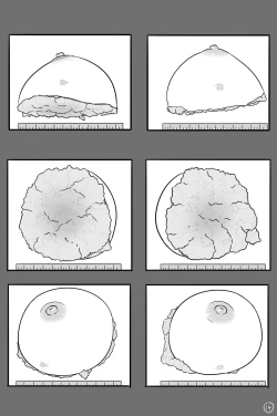 Page 15 of Xinhua Castration Diary 1