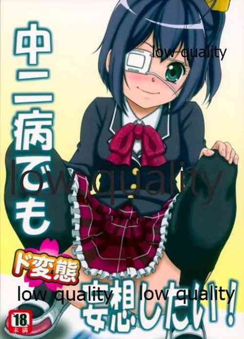 Download Chuunibyou Demo Dohenta Mousou Shitai