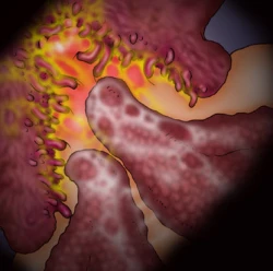 Page 41 of 触肉強触 1-7