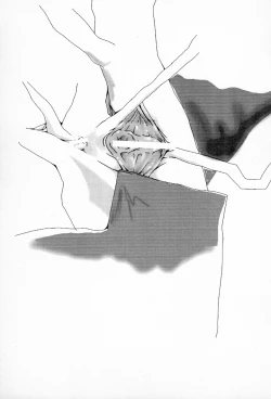 Page 11 of Pliant horror