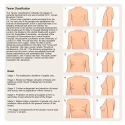 Page 4 of Shoujo Hatsuiku Nenji no Keikou to Tenbou