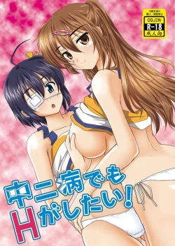 Page 1 of Chuunibyou demo H ga Shitai!